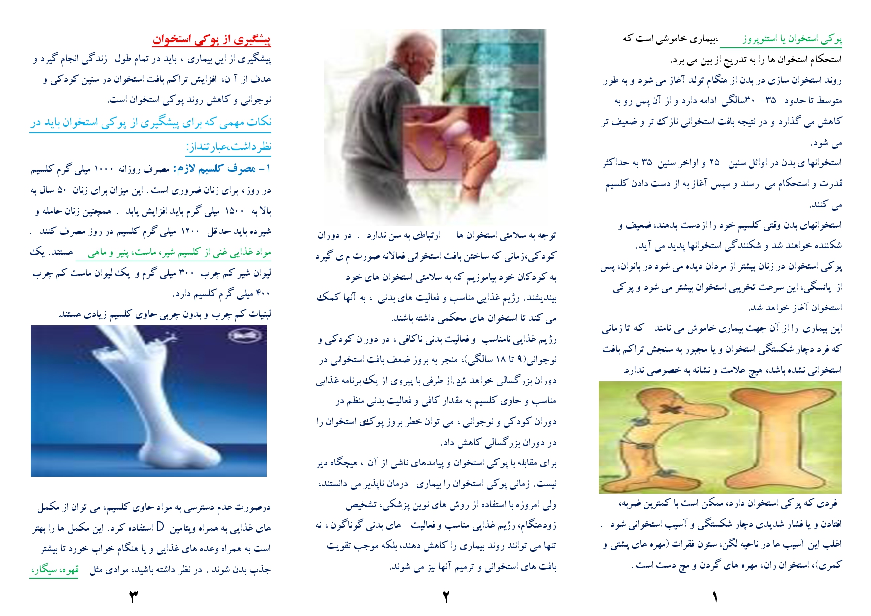 پوکی استخوان